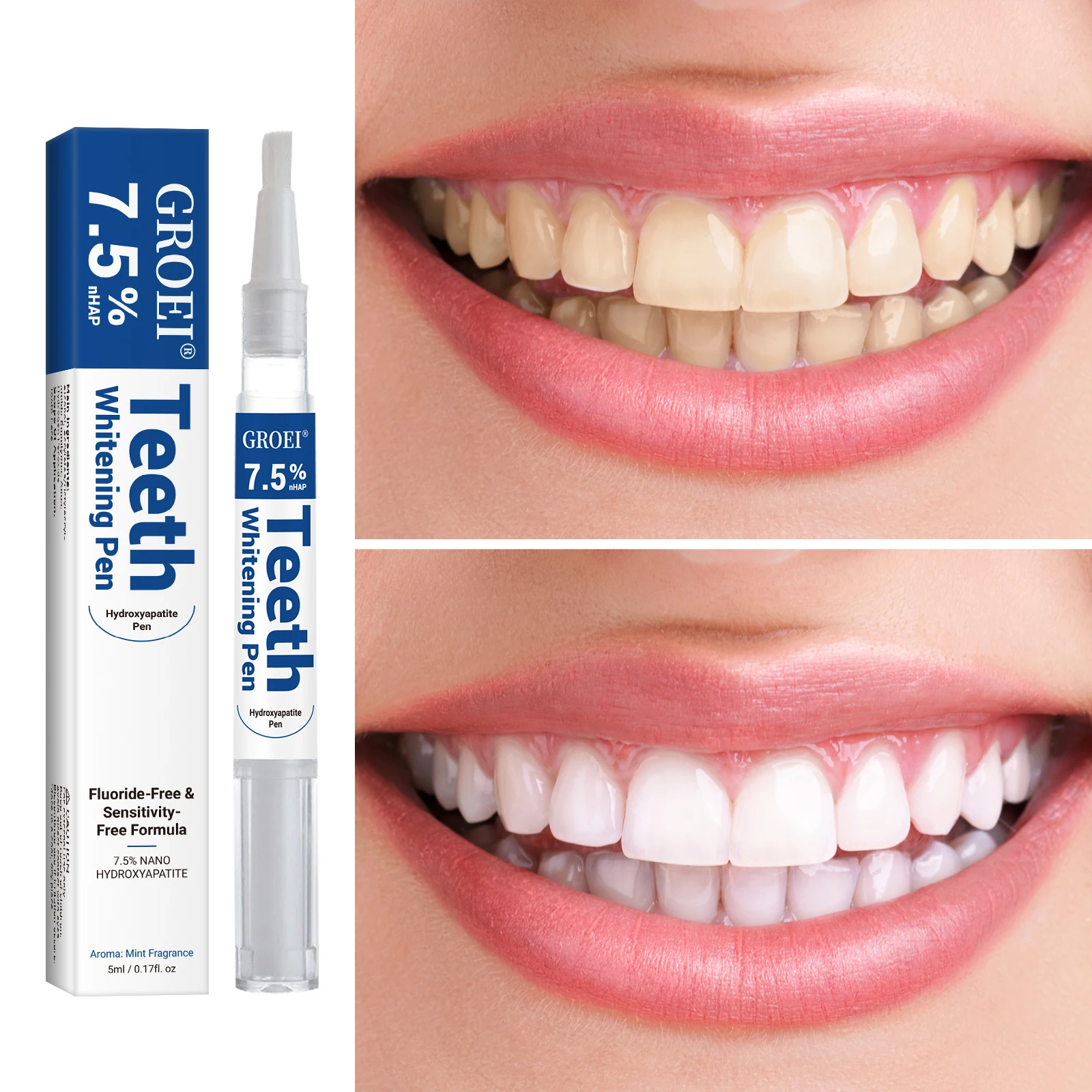 Hydroxyapatite Tooth Whitening - đánh giá và giá Teeth Whitening Pens