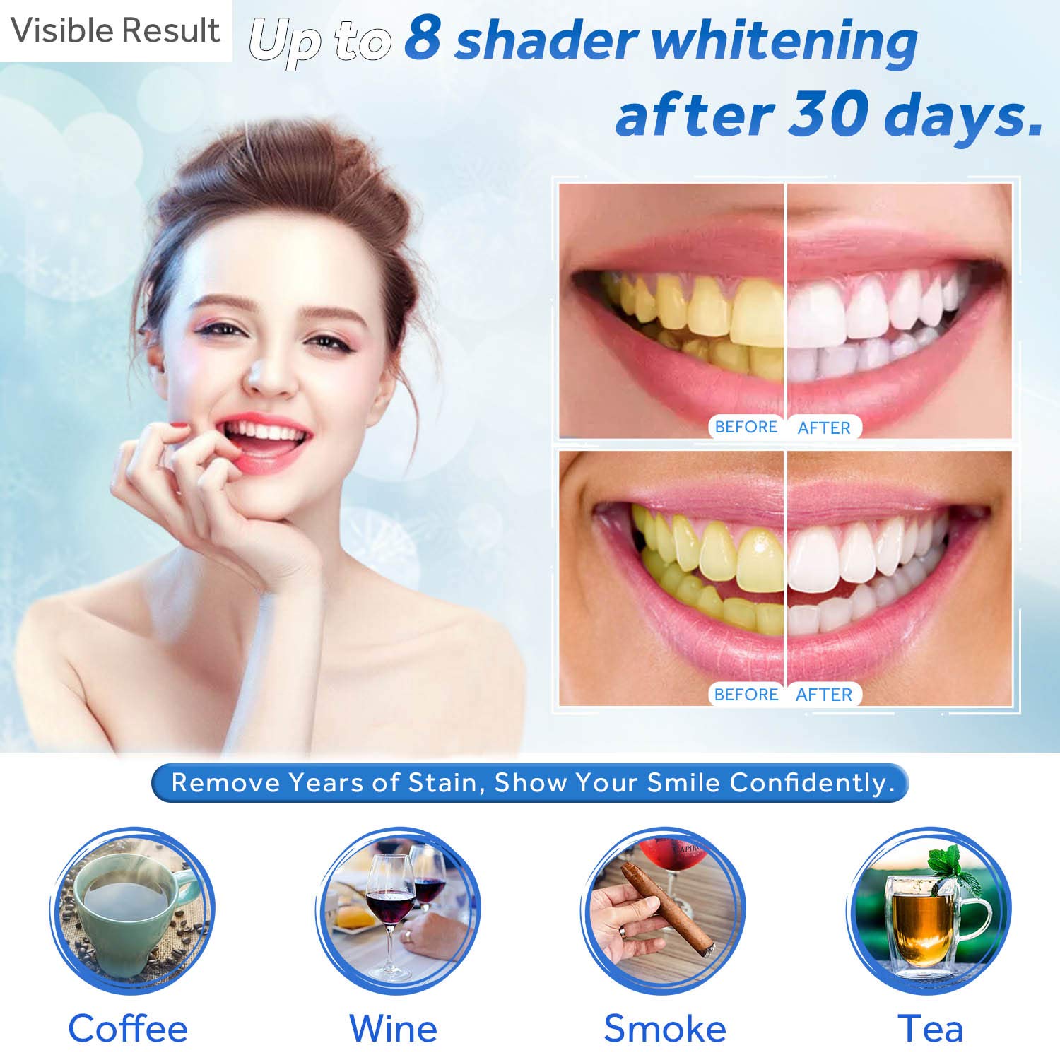 Teeth Whitening Gel Refill Syr - đánh giá và giá Teeth Whitening Pens