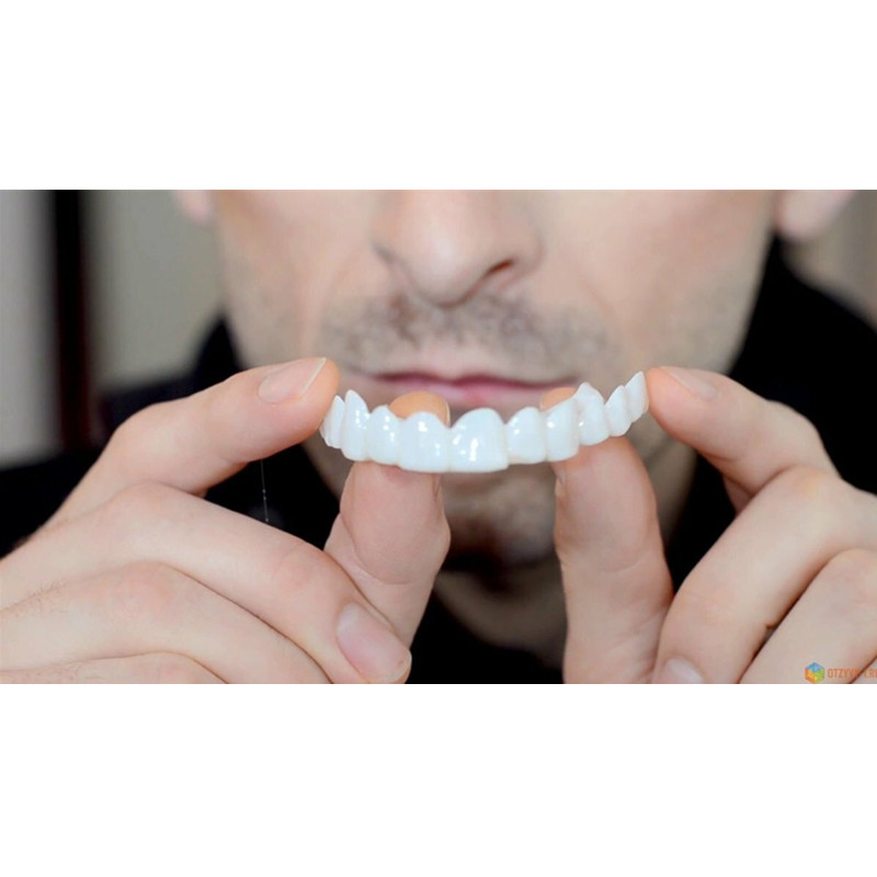 Mềm Dẻo Silicone Gel Nha Khoa  - đánh giá và giá Teeth Whitening Moulds