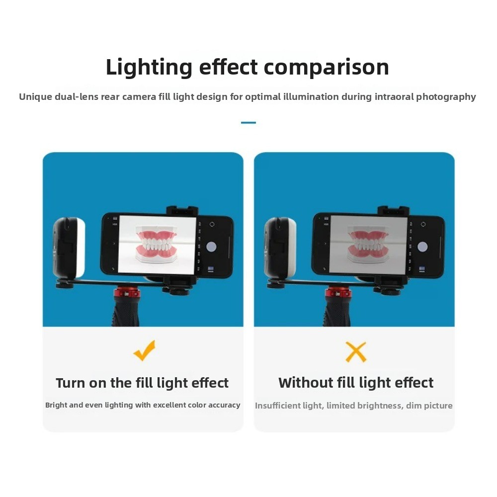 Dental Photography Light, Blue - đánh giá và giá Teeth Whitening Kit
