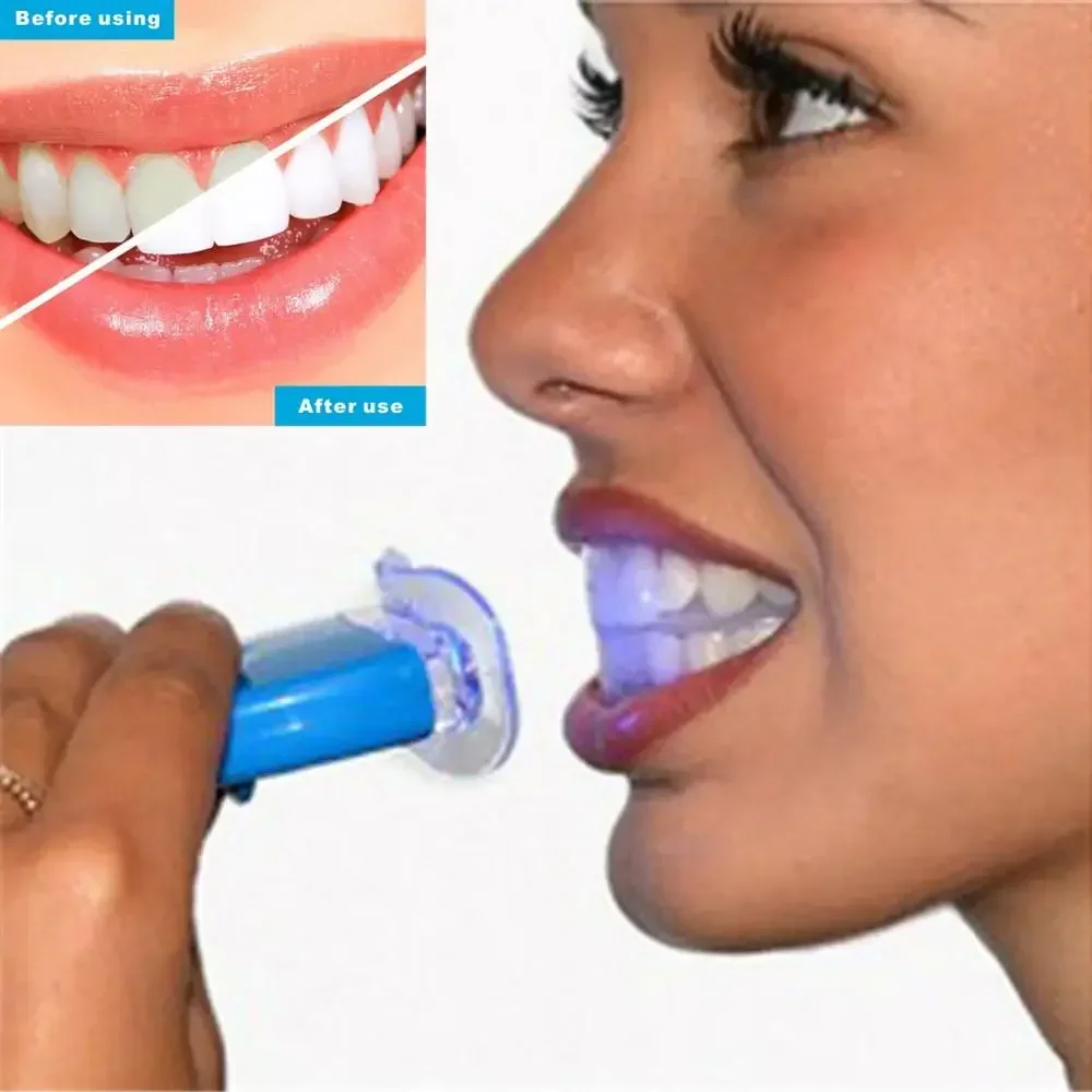 USB Quick Charge Beard & Body  - đánh giá và giá Teeth Whitening Kit