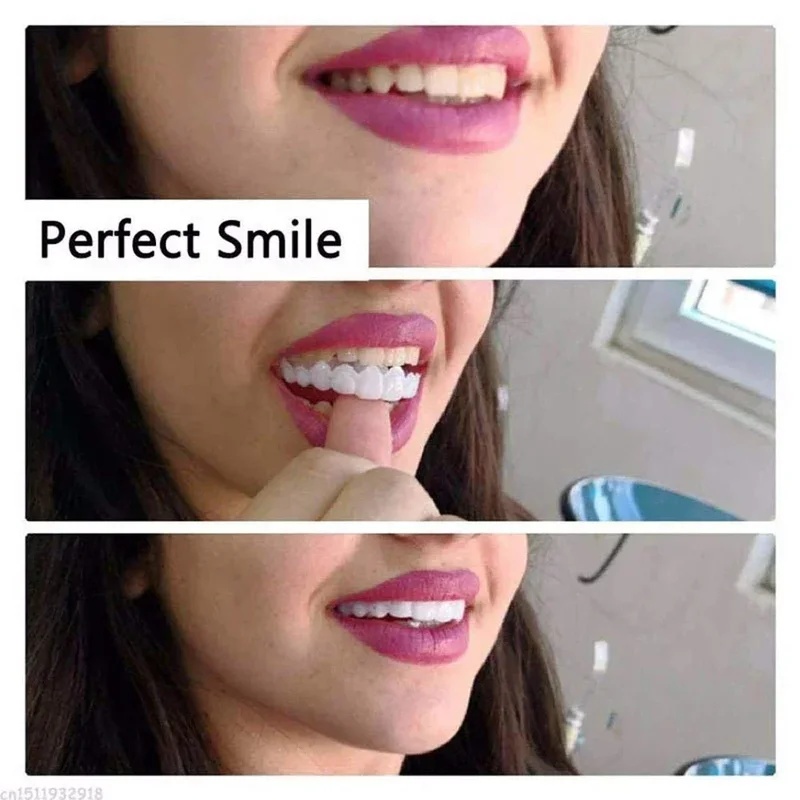 Snap-on Veneer Teeth Kit Adjus - đánh giá và giá Teeth Whitening Kit